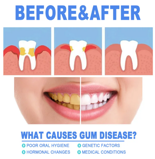 Teeth Repair & Gum Relief Gel
